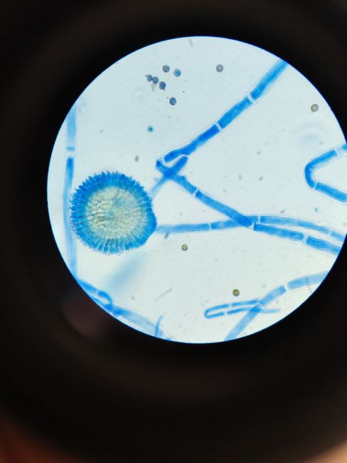 Close-up image of fungal hyphae and spores under a microscope, stained blue.